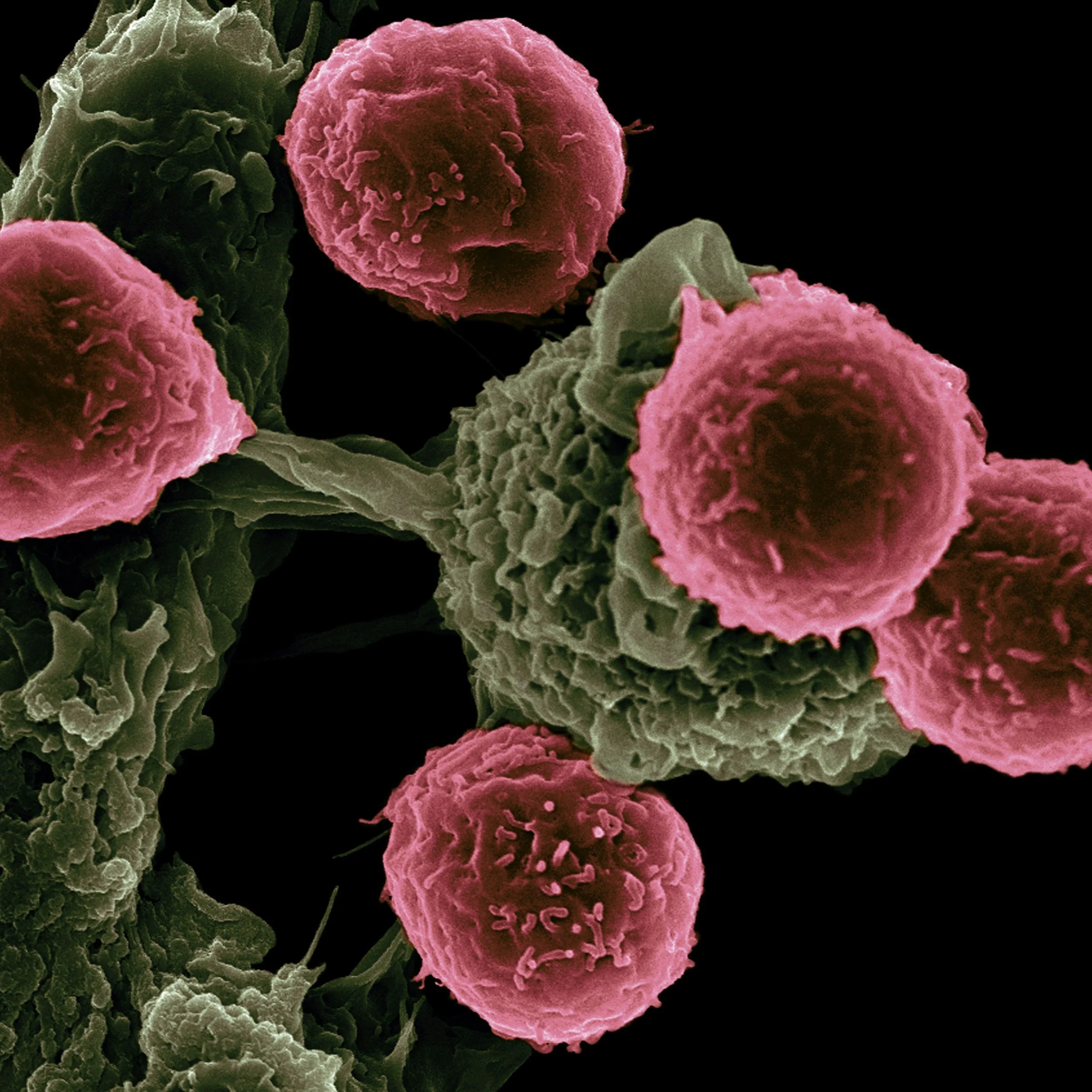 Conquering Cancer with Synthetic Biology