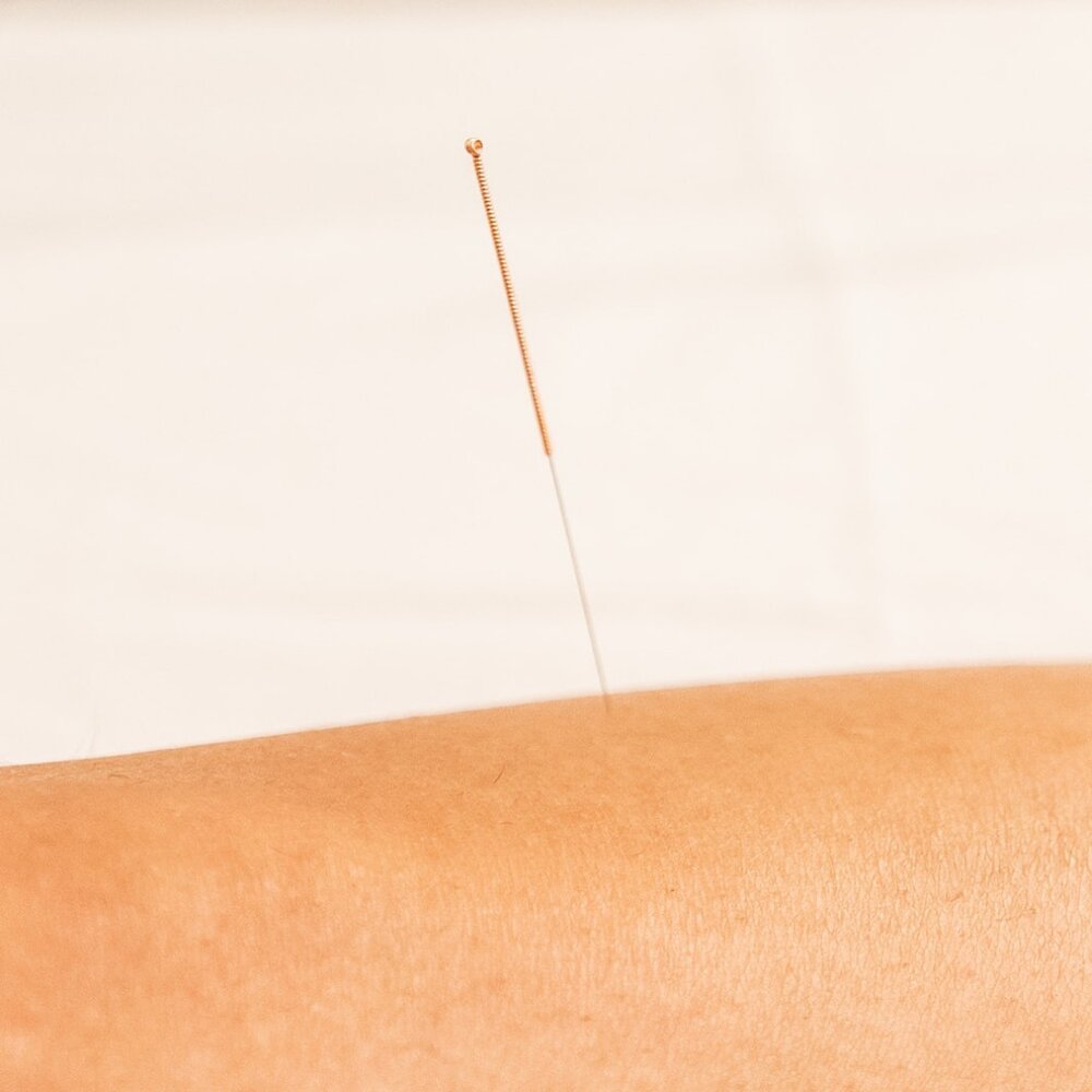 How does acupuncture work? This question is fully loaded! In simplest terms these magical little tools guide the harmony that occur in our bodies. Energy is flowing through our bodies, our universe... We are ENERGY.
When there is PAIN there is a bloc