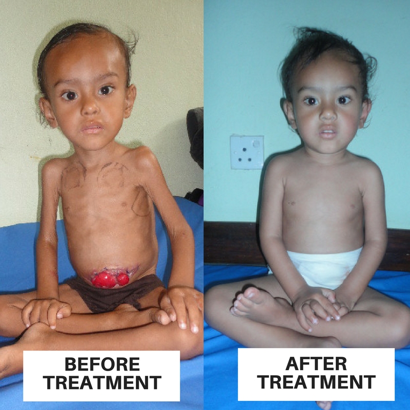 BEFORE & After TREATMENT.jpg