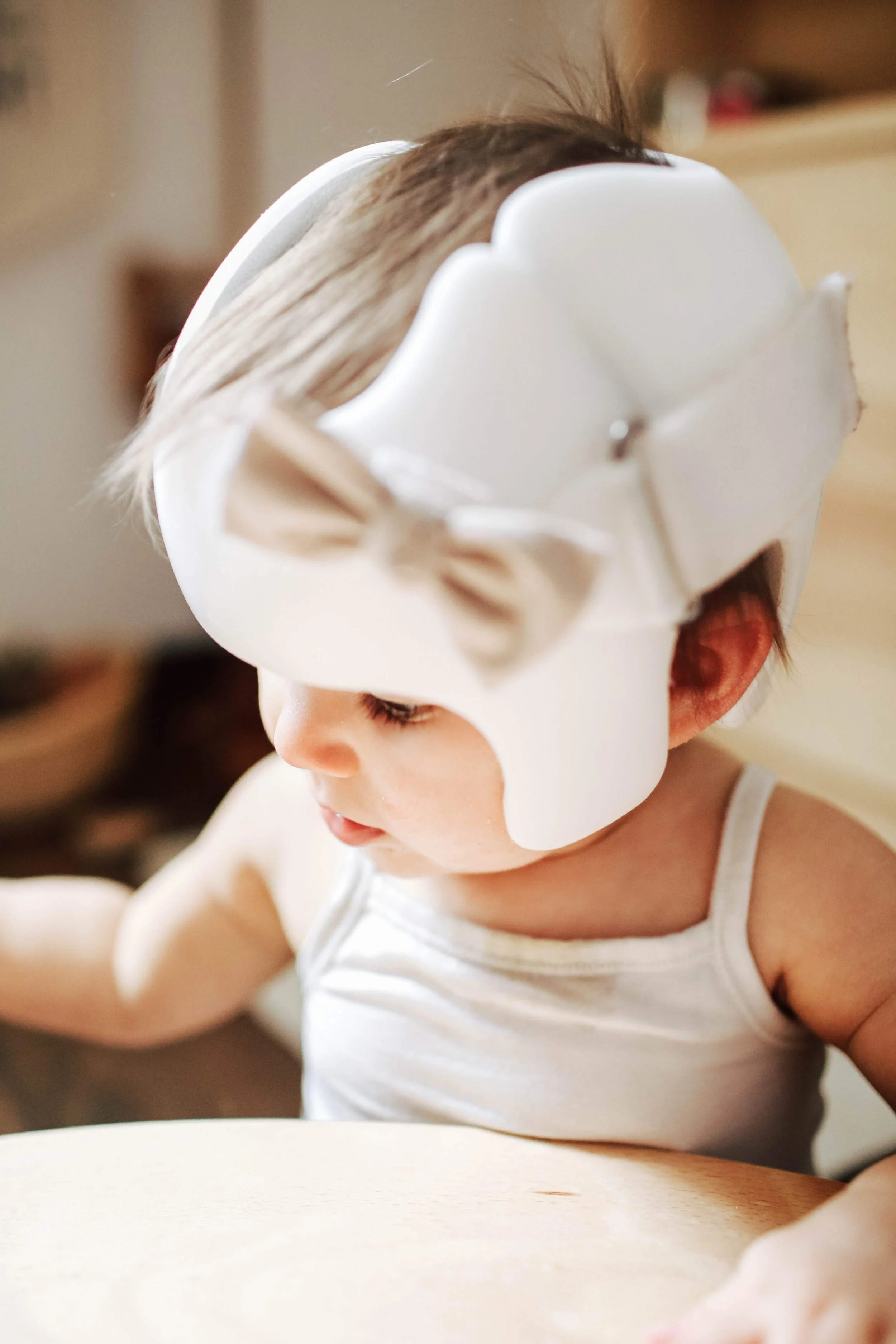 Babies Wear Helmets Baby Helmet To Reshape Head Wear Helmets