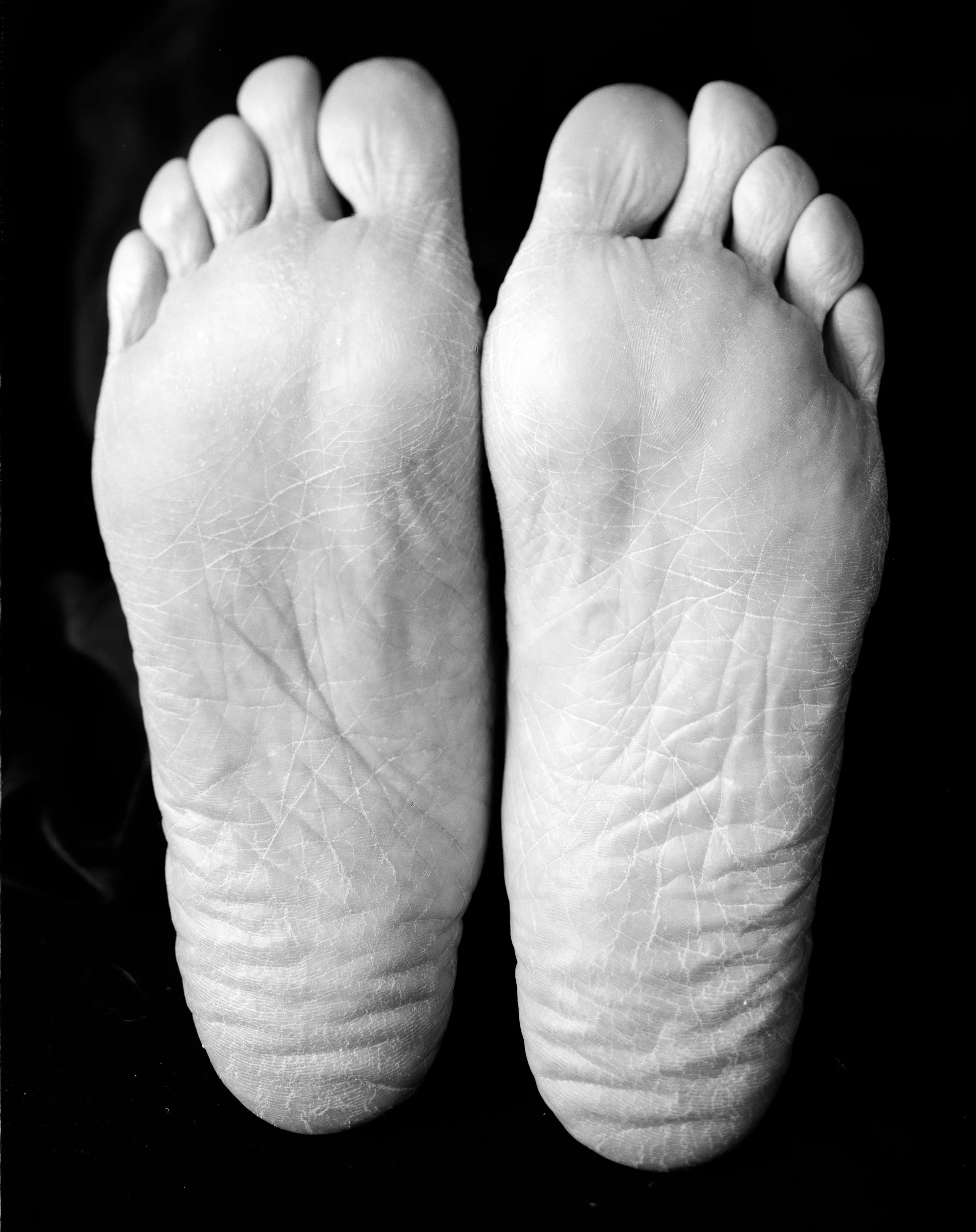  detail of  Cold Feet , quadtone inkjet print, 2005 