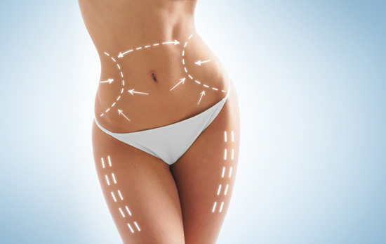 Liposuction.jpg