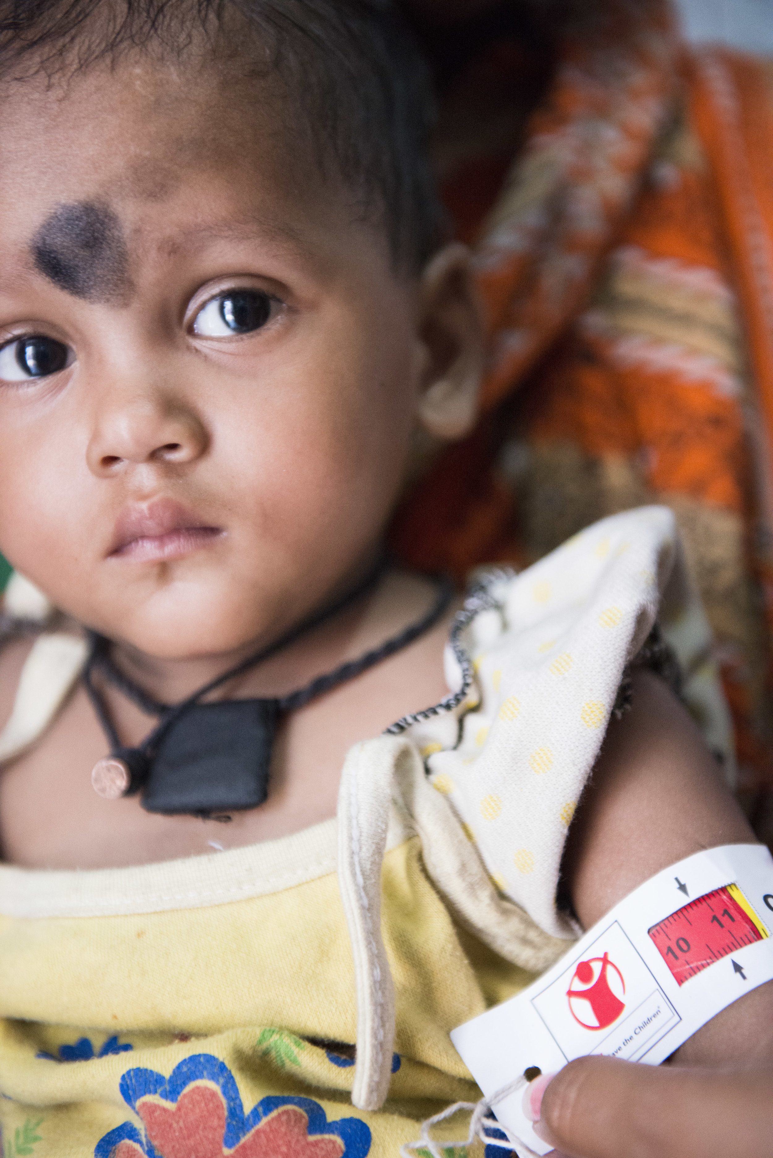 Nutrition clinic and MUAC test. Kolkata, India. 2015.