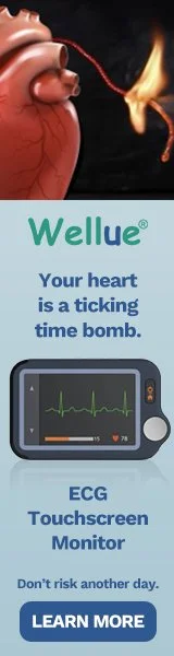 Wellue ECG Touchscreen Monitor