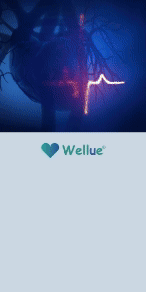 Wellue_Display_30SecondTest_300x600_S.gif