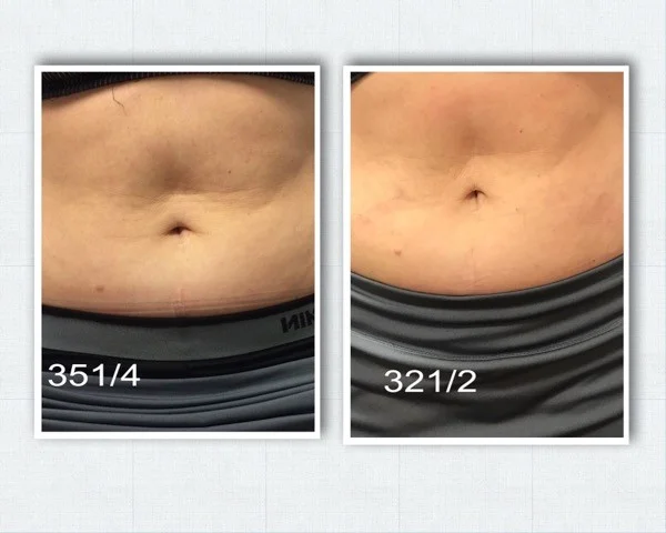 beforeafter.jpg