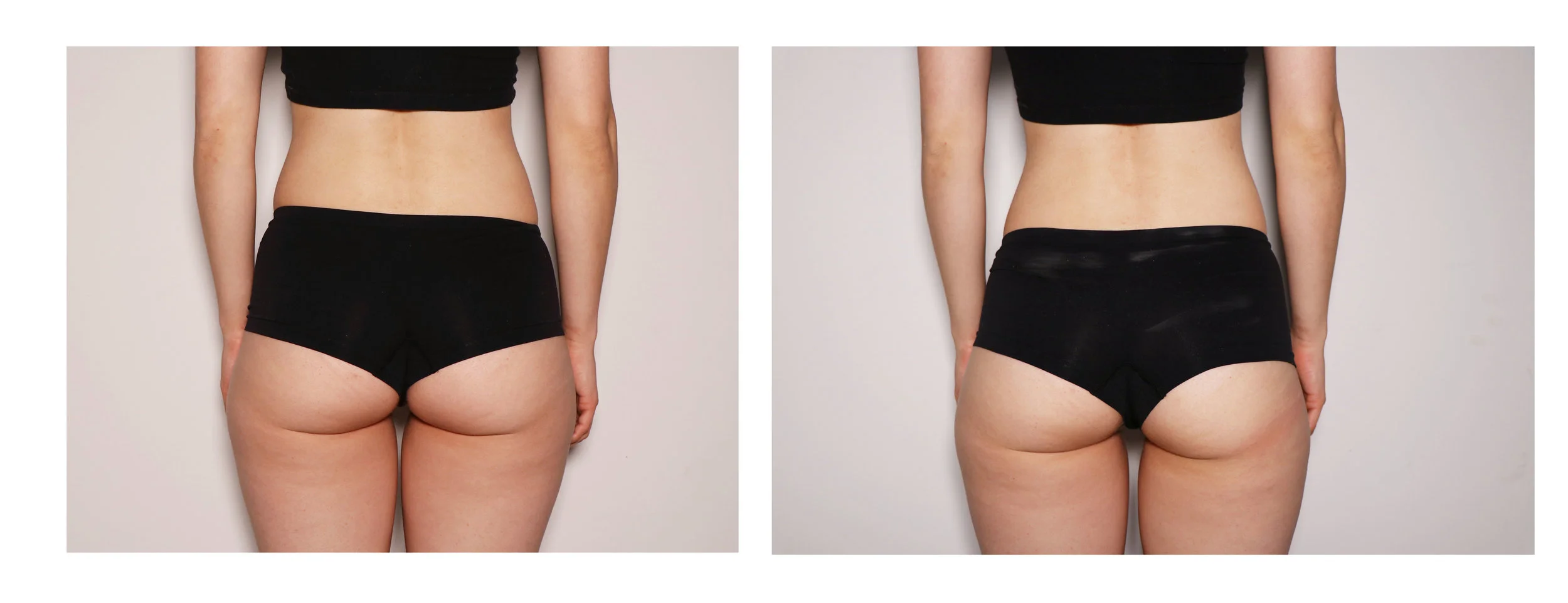 Female Butt Toning.jpg