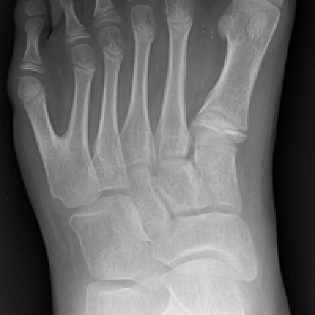 feet-polydactyly-1024x1024.jpg