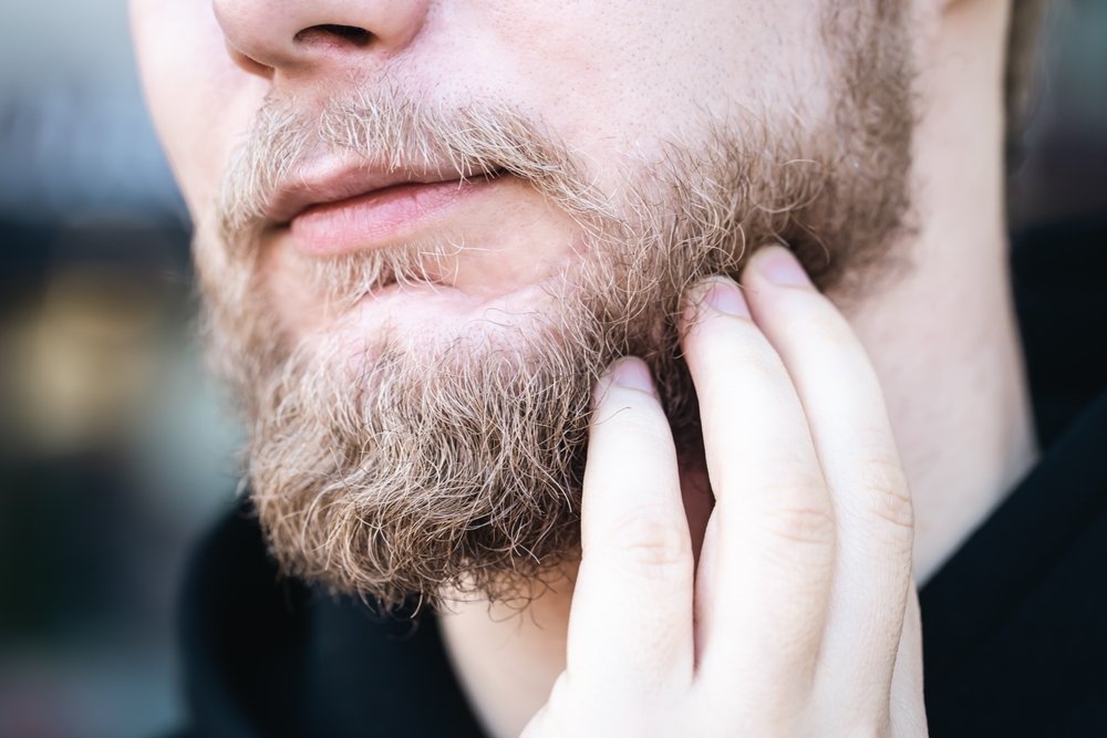 The Bearded Man's Struggle Against "Bearddruff": What Can Be Done?