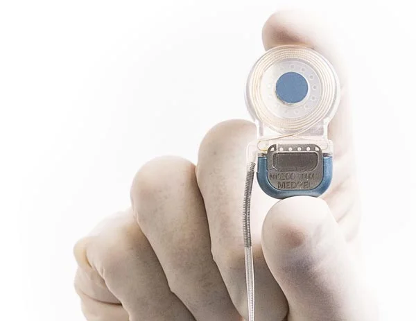 Cochlear-Implant-Evaluation.jpg