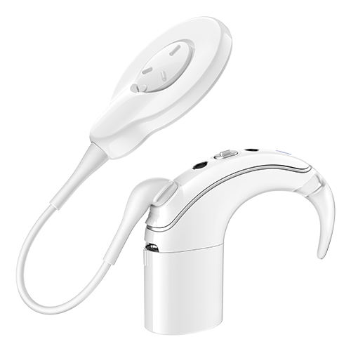 Common Questions about Cochlear Implants