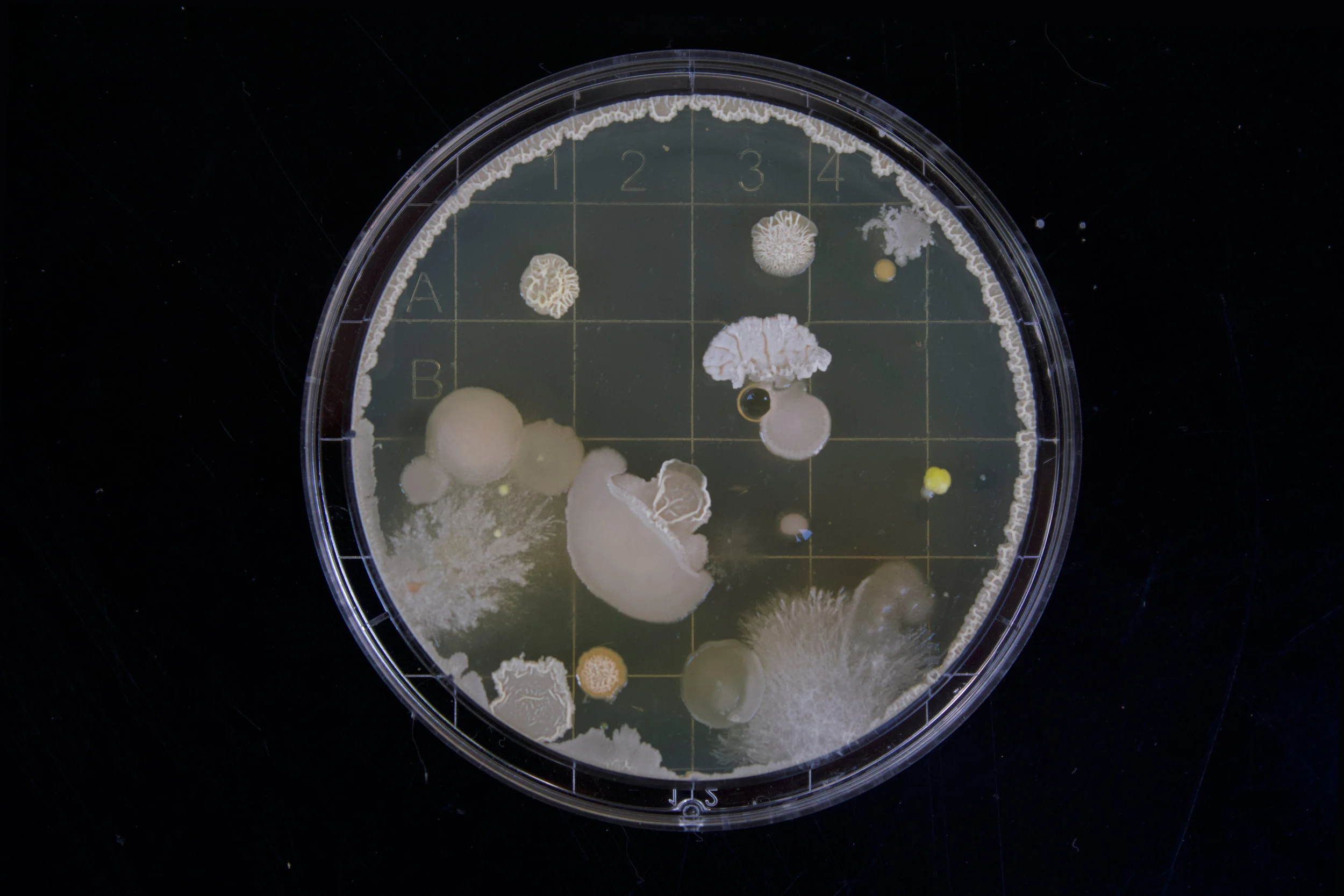 Getting Smart about Antibiotics – Preventing Antibiotic Resistance