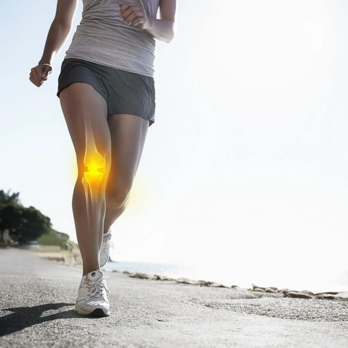 Running and Patellofemoral Pain Syndrome