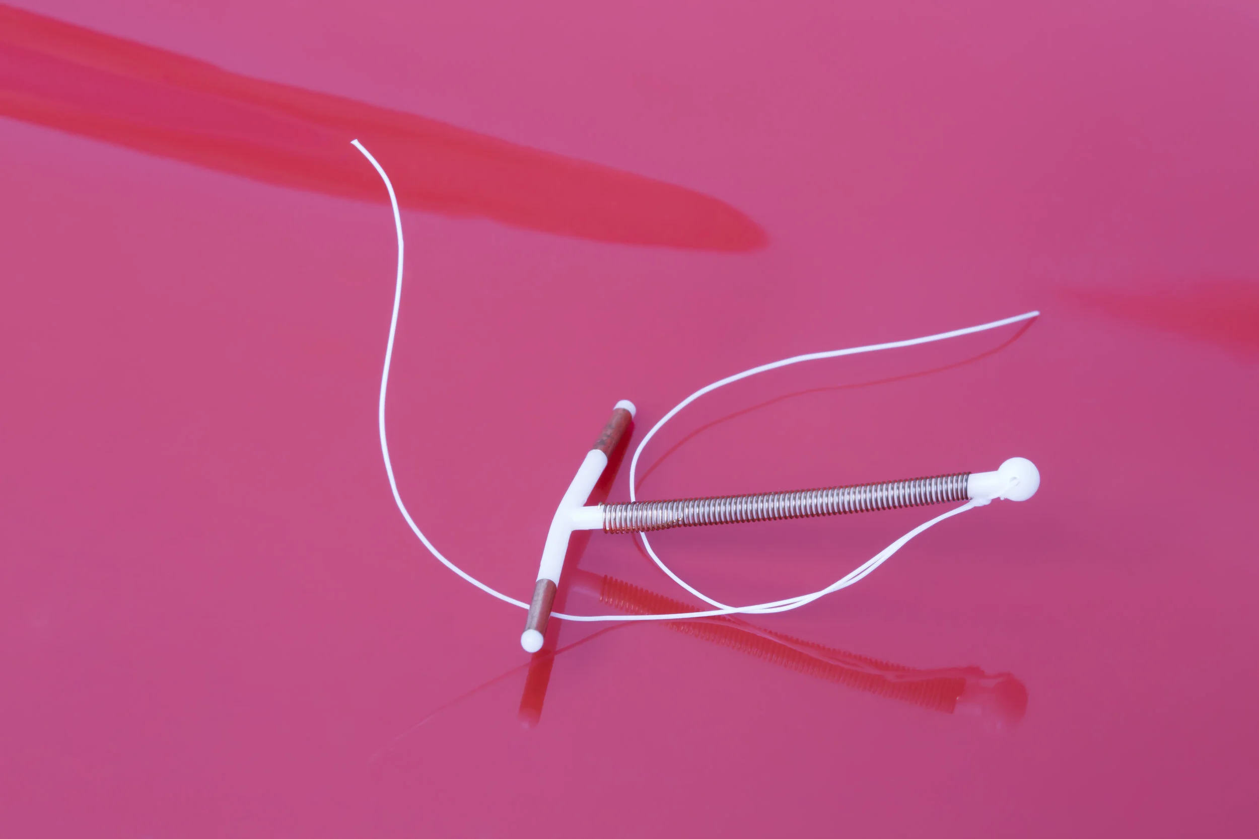 Six things you may not know about IUD’s