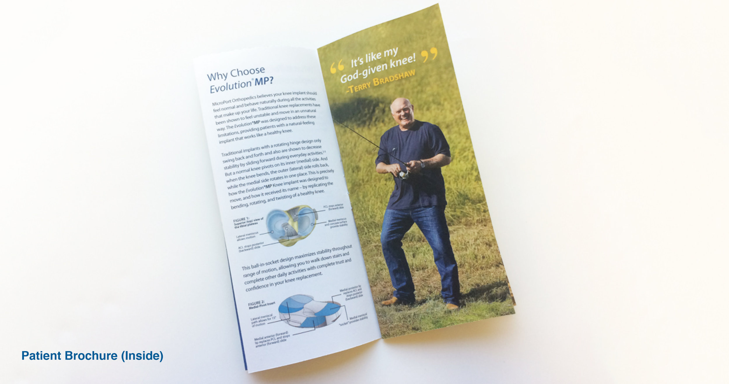 MicroPort: EvolutionMP Patient Marketing Campaign: Patient Brochure