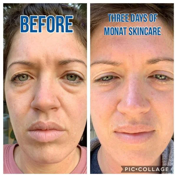 MONATSkinPhoto3.jpg