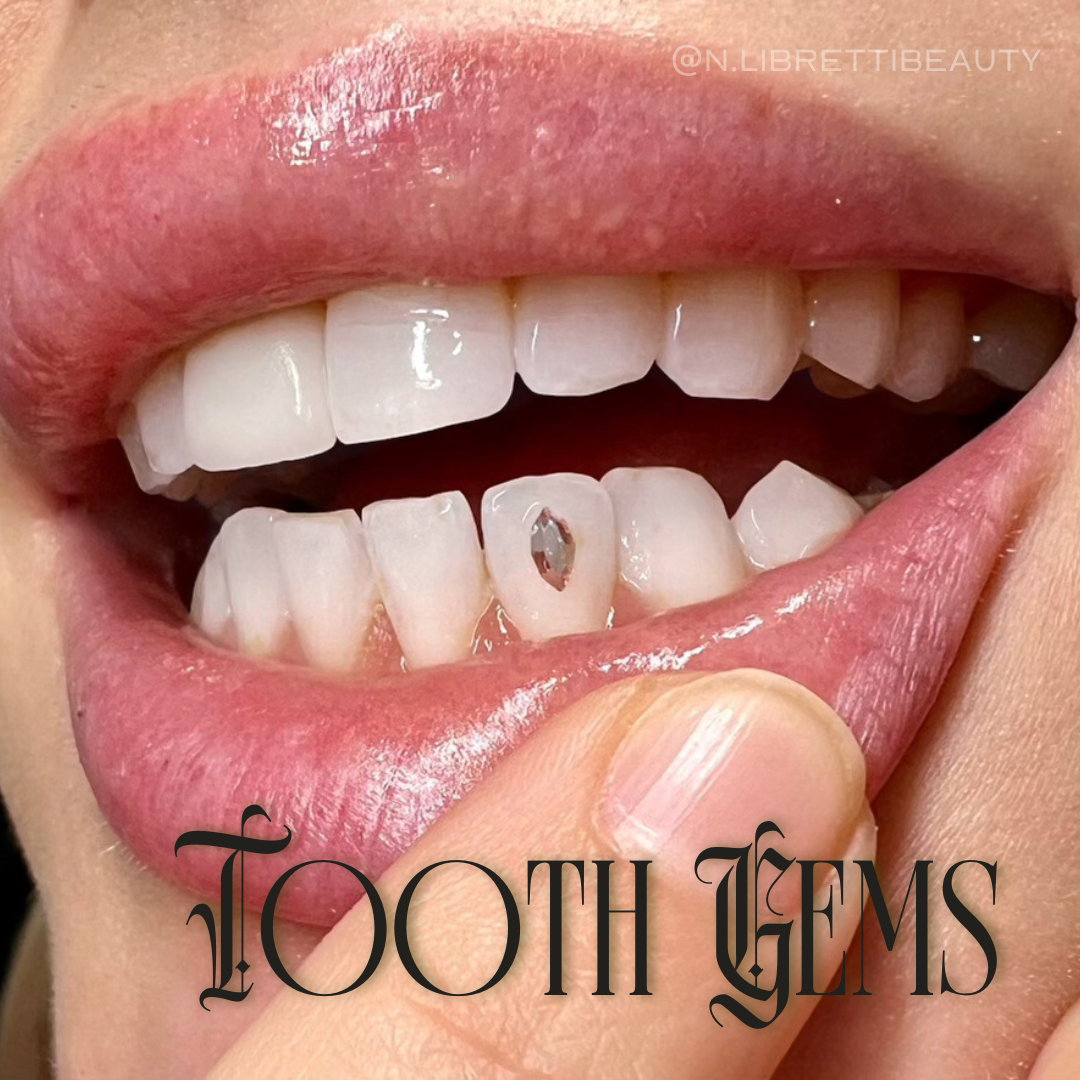 Tooth Gems