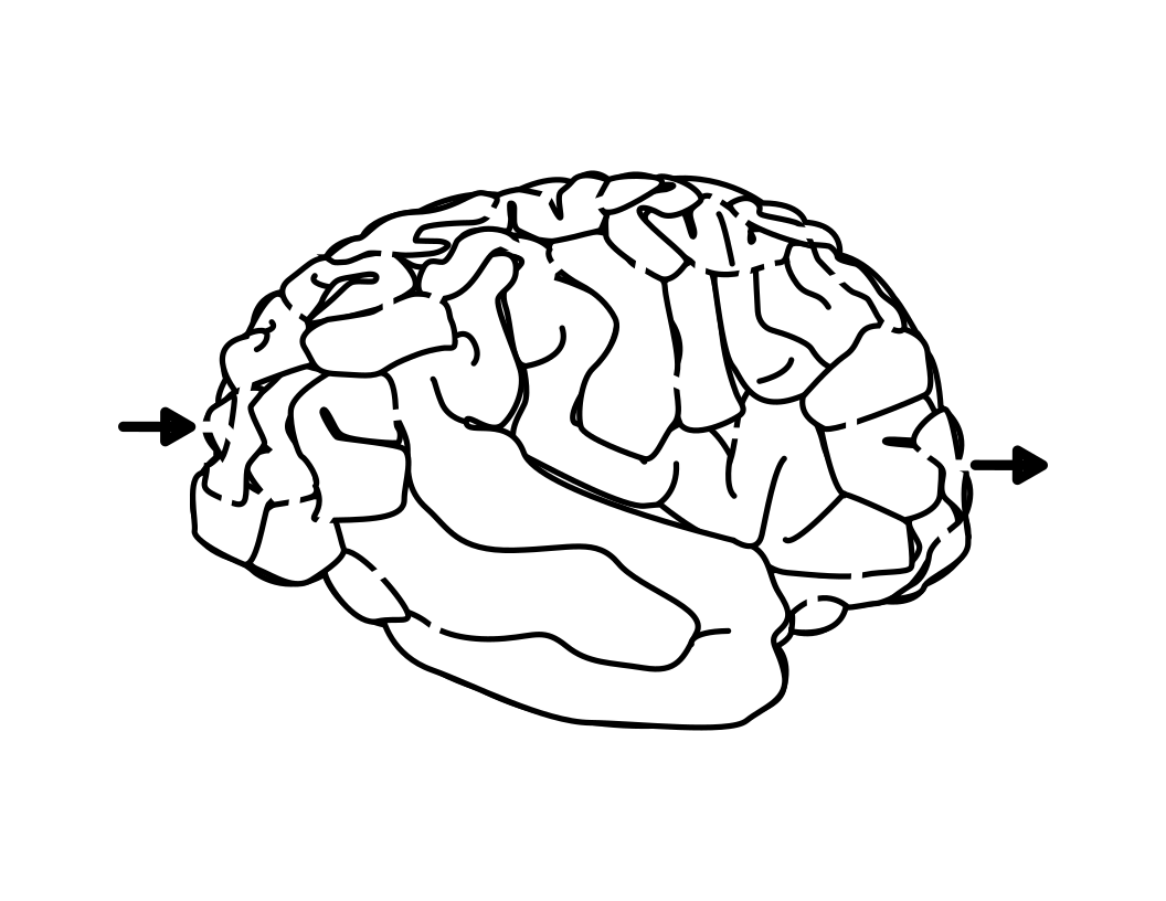 Brain Maze in black and white