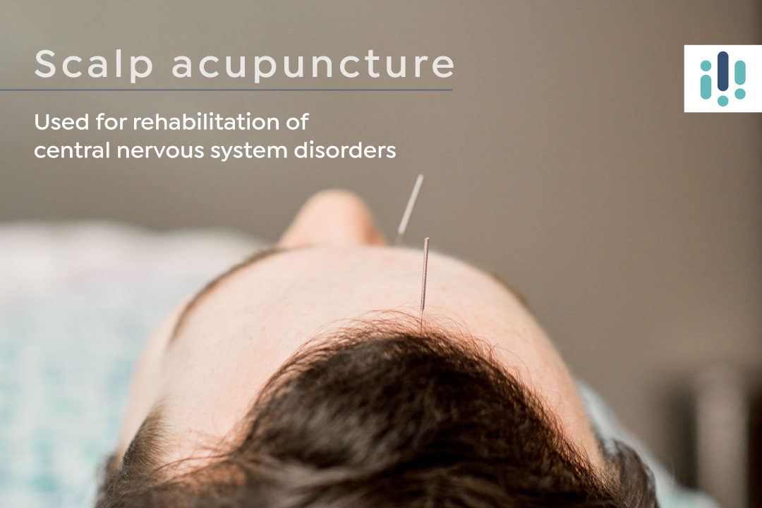 What is Scalp Acupuncture?