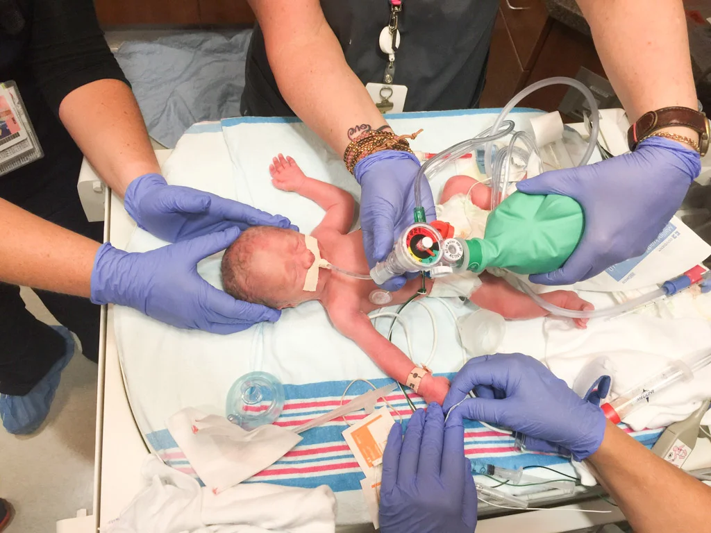 birth-story-30-weeks-abroad-wife.jpg