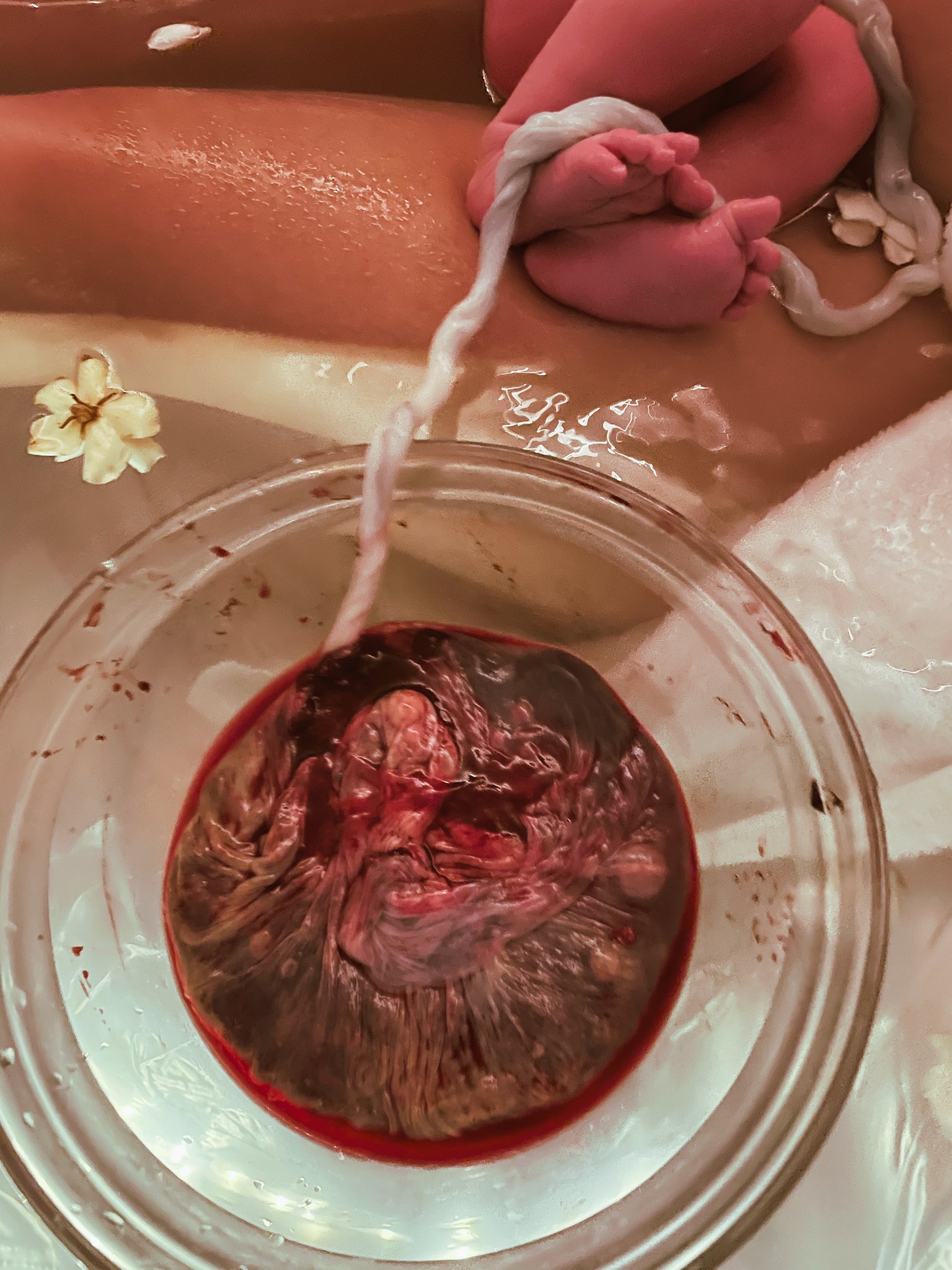 Placenta.jpg
