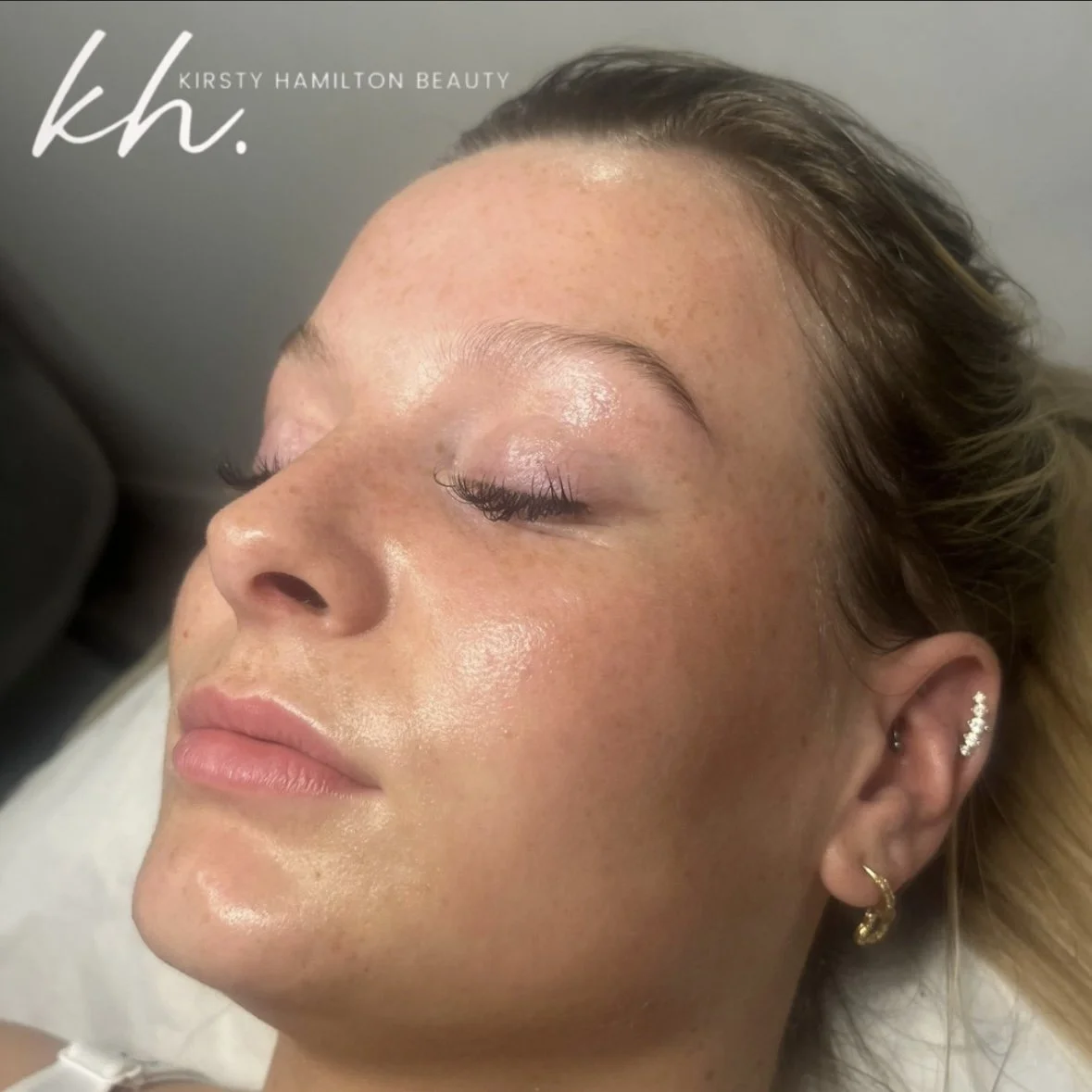 Million dollar facial.jpg