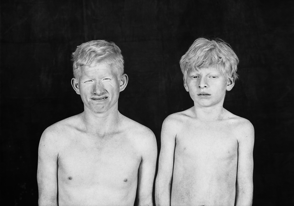 15.Albinos.jpg