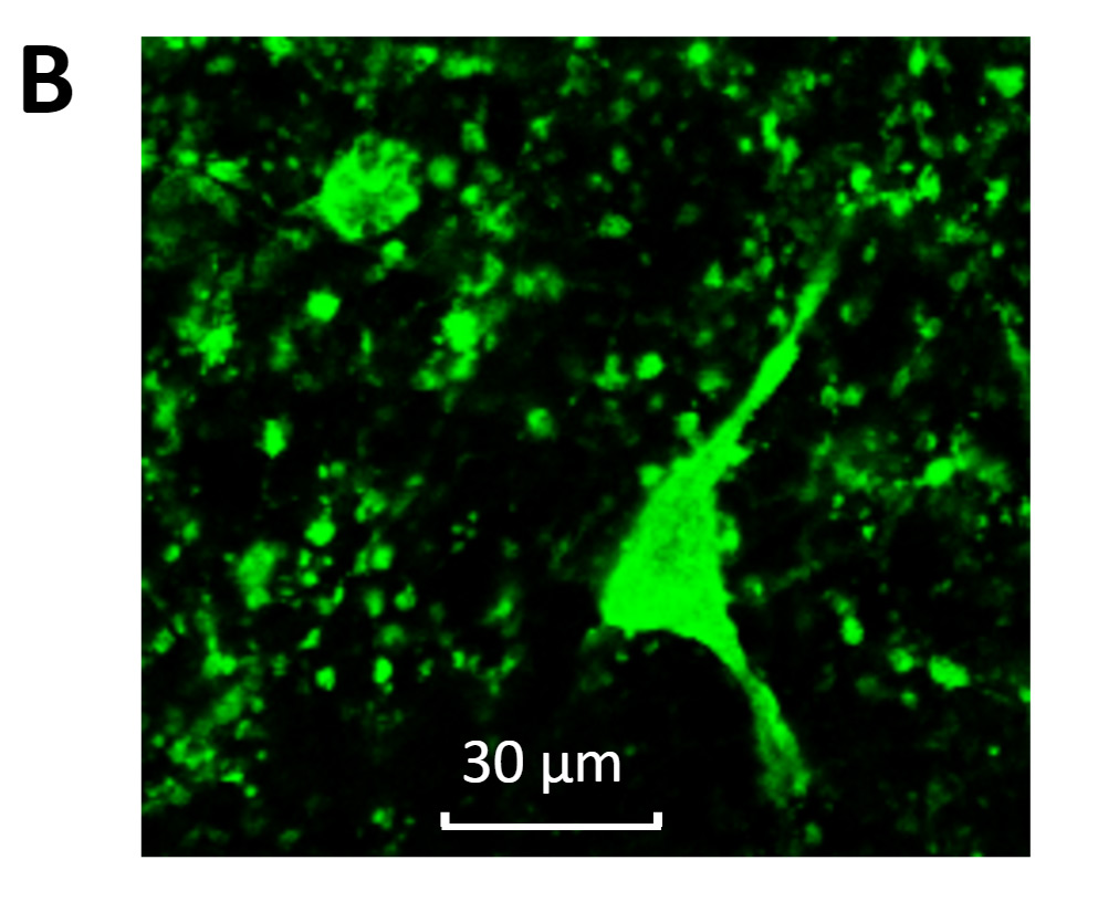 optogenetic-control-b.jpg