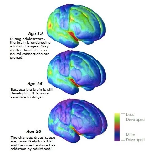 https://adolescentbrain-coltoncook.weebly.com/see-whats-happening-inside-of-the-teenage-brain.html