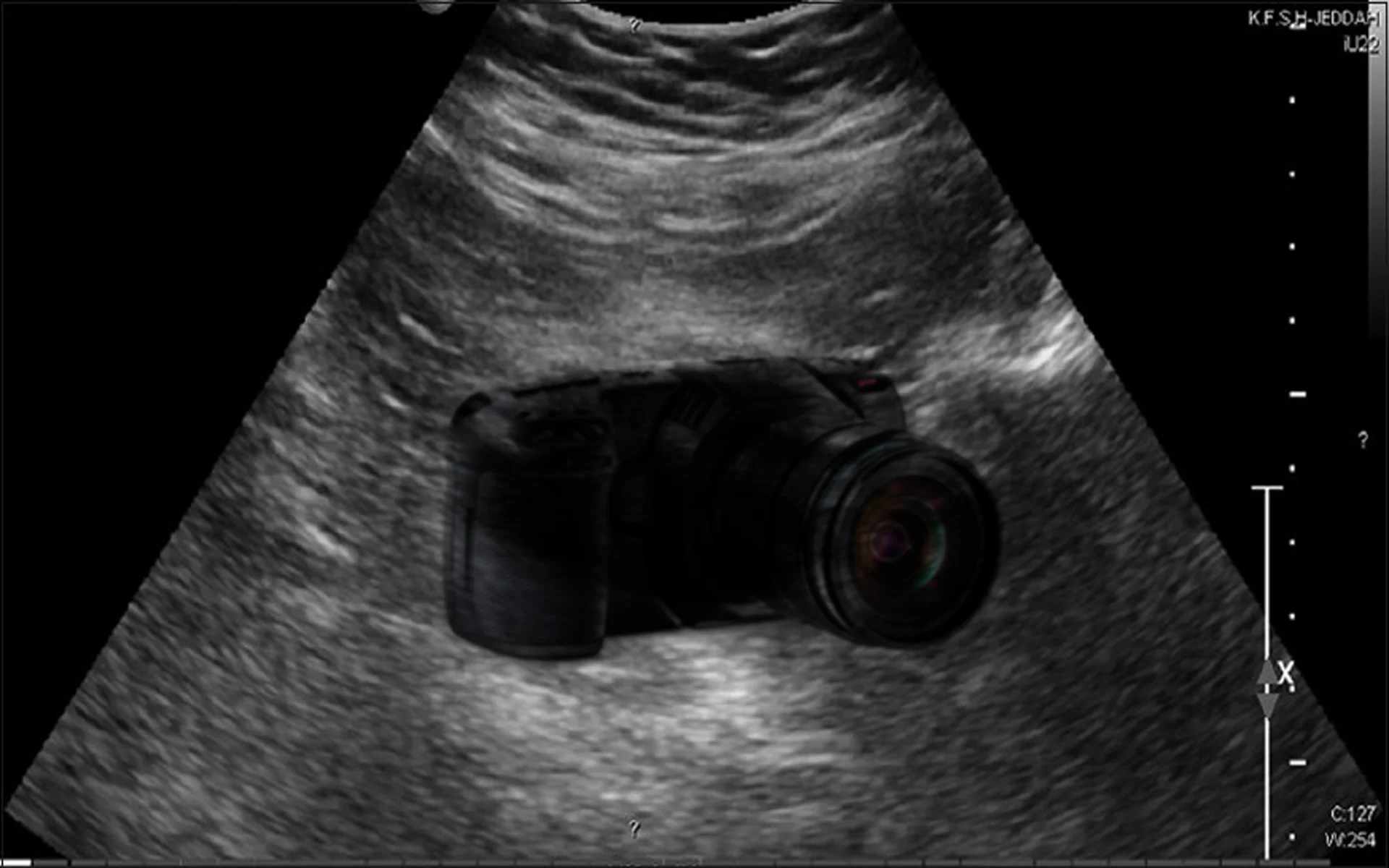 pelvic-ultrasound.jpg