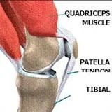 PATELLAR TENDONITIS