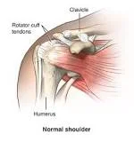 Rotator Cuff 