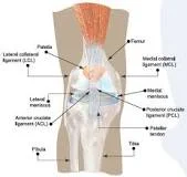 ACL TEAR
