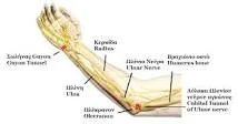 Cubital Tunnel Syndrome