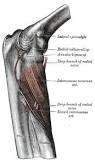 Supinator Syndrome
