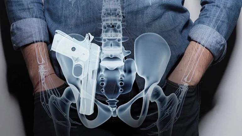 aiwb-xray.jpg