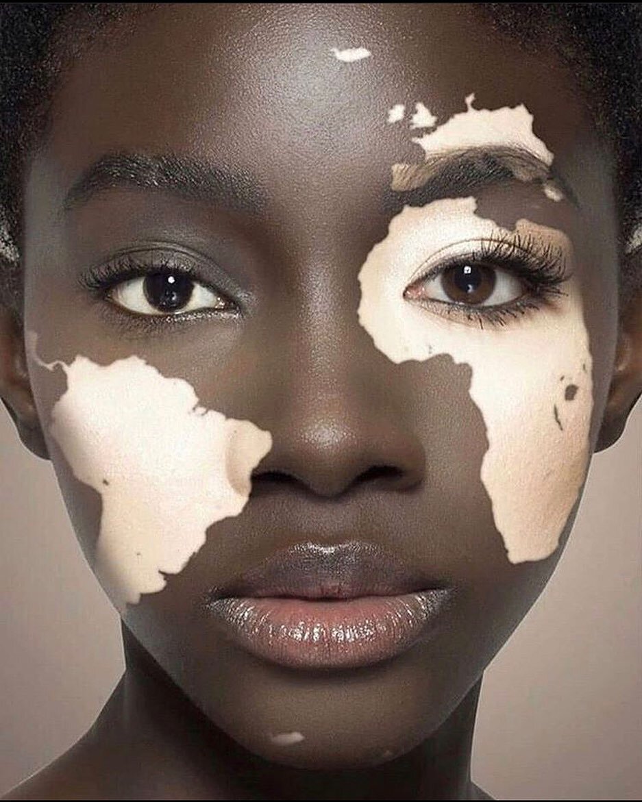 She understands her role in the world and does it well. 
.
Unknown artist we 💛
.
.
.
#awominaturals #beautifulskin #blackownedbeautybrands #blackwomanownedbusiness #blackfemalemodels #vitligo