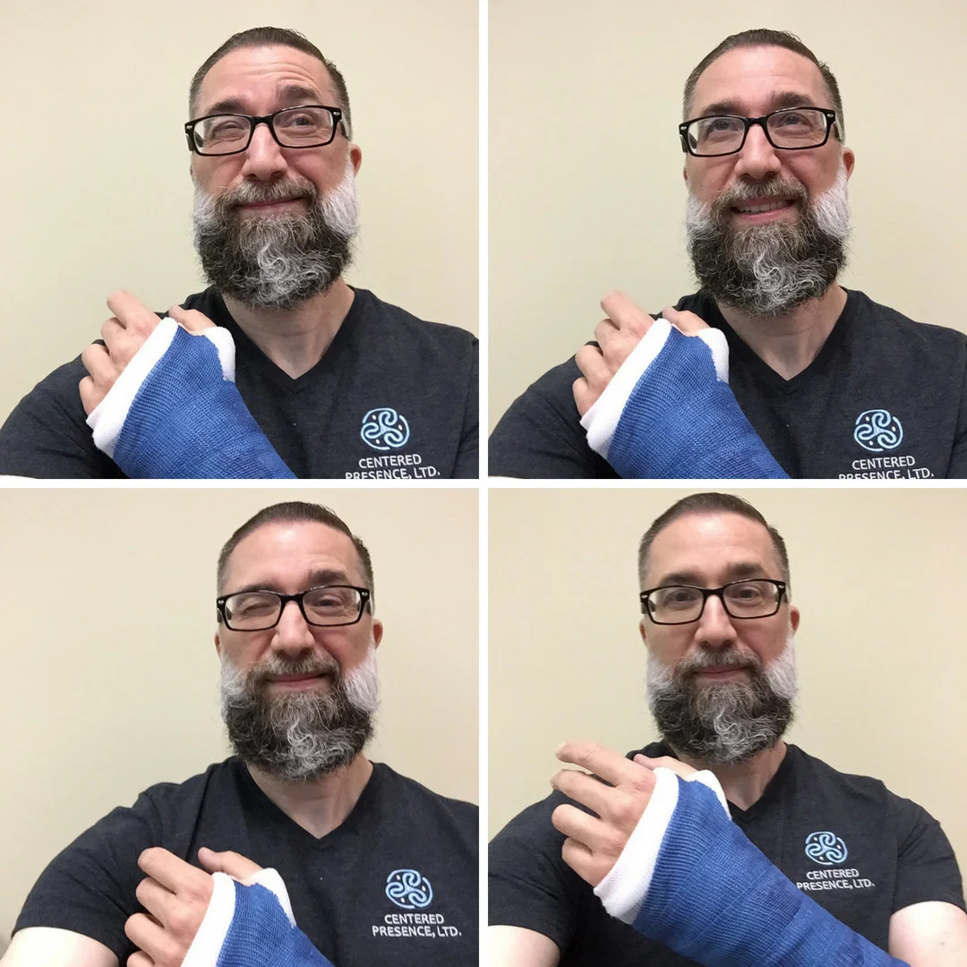 Photos of Michael Patrick and broken arm