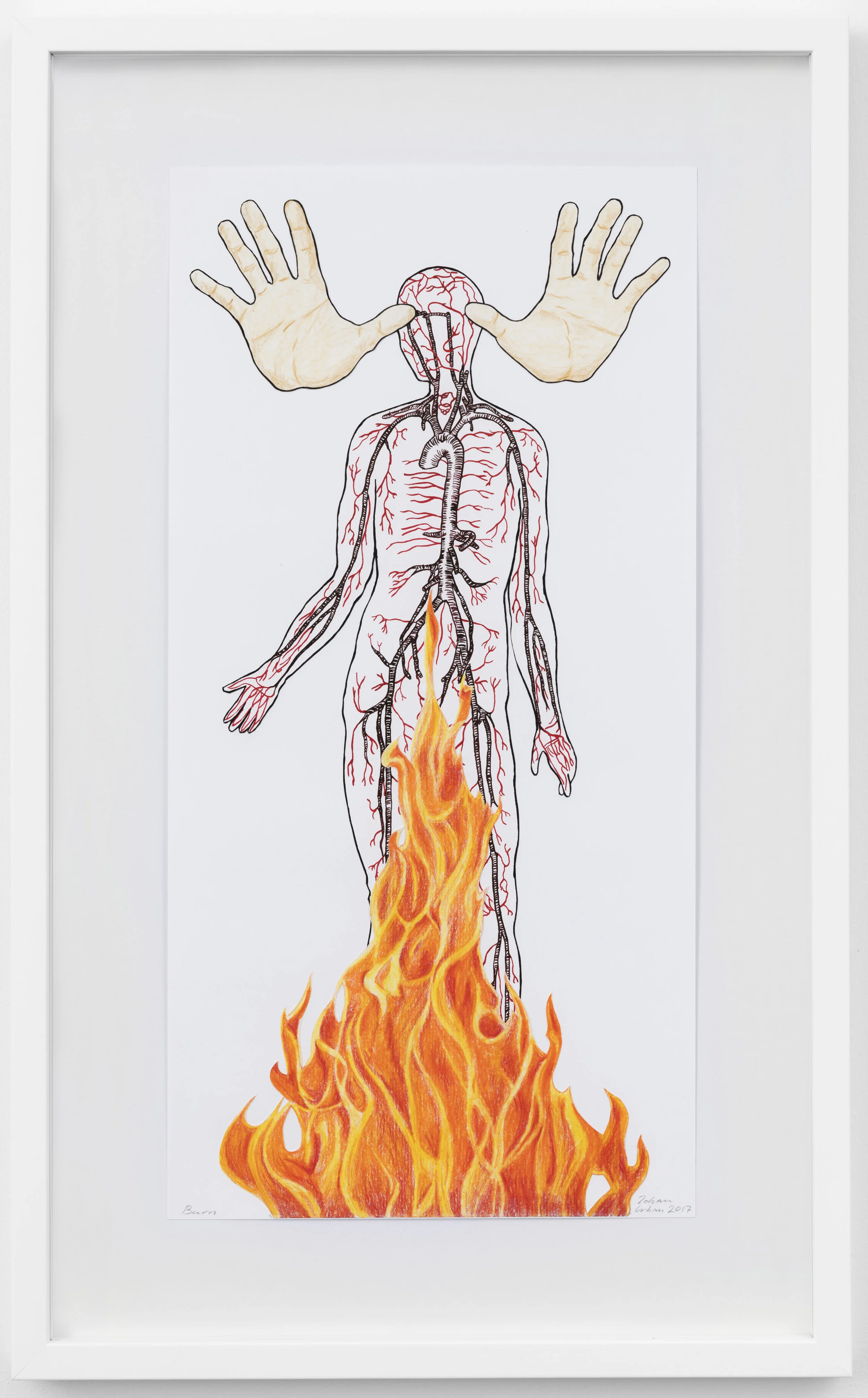 Burn