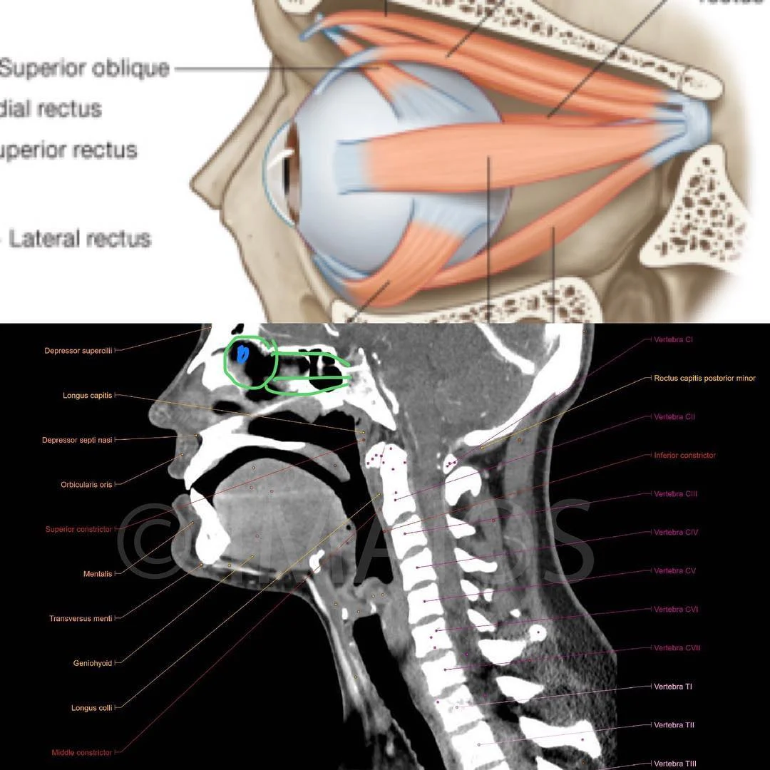 Notice the depth of the eye socket, how far the eye muscles go back, and how close they are in relation to the soft palate, top of the spine and base of the skull (and soft palate).