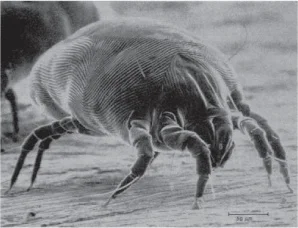 Dust mites. These bad boys can cause allergic reactions in sensitive people.
