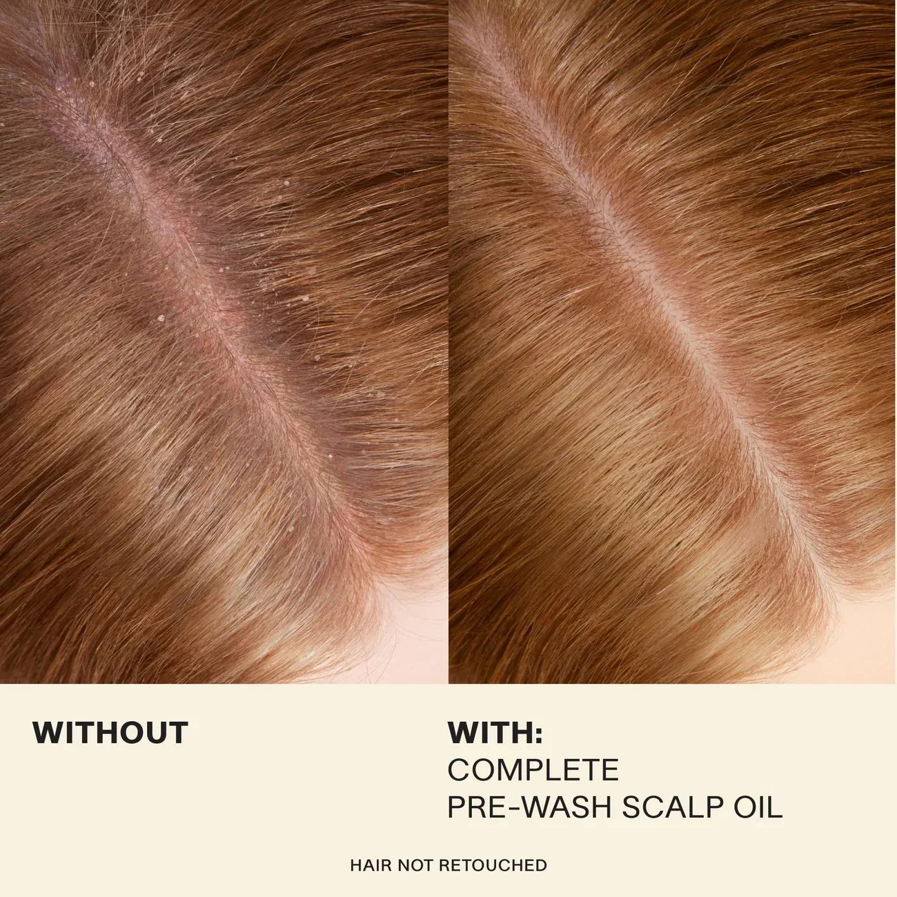 jvn-treatment-jvn-pre-wash-scalp-oil-rosemary-infused-scalp-treatment-complete-pre-wash-scalp-oil-35651298689213.jpeg