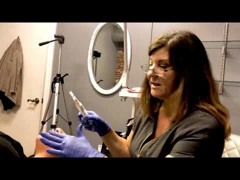 How We Do It: Microneedling Facial Rejuvenation 