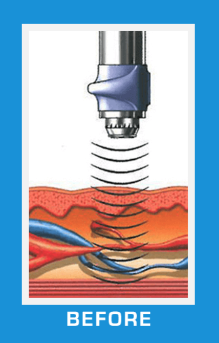 Intro to Gainswave®