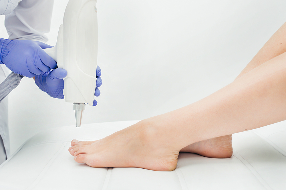 Laser Treatment for Warts, Toenail Fungus Podiatrists in Cherry Hill, NJ & Ridley Park, PA