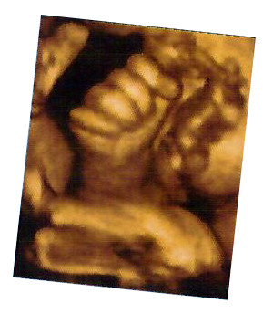 4D Ultrasounds in Hammond, LA