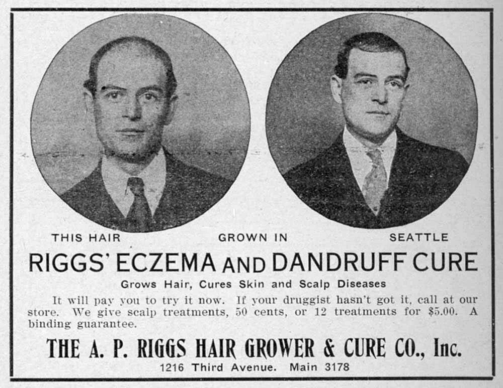 The Truth About Winter And Flakes (And What to Do About It)