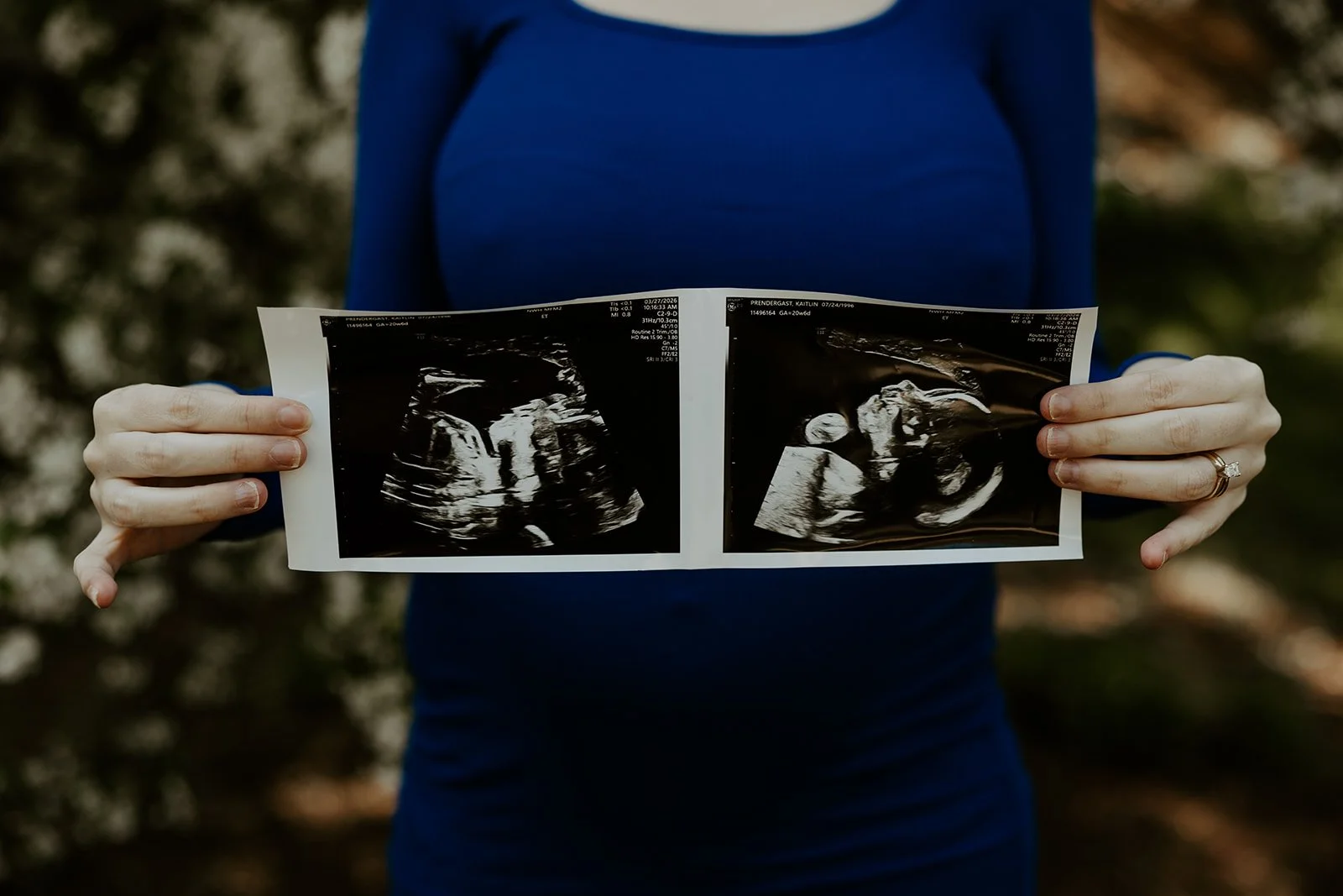 A woman holding her ultrasound during a maternity photoshoot