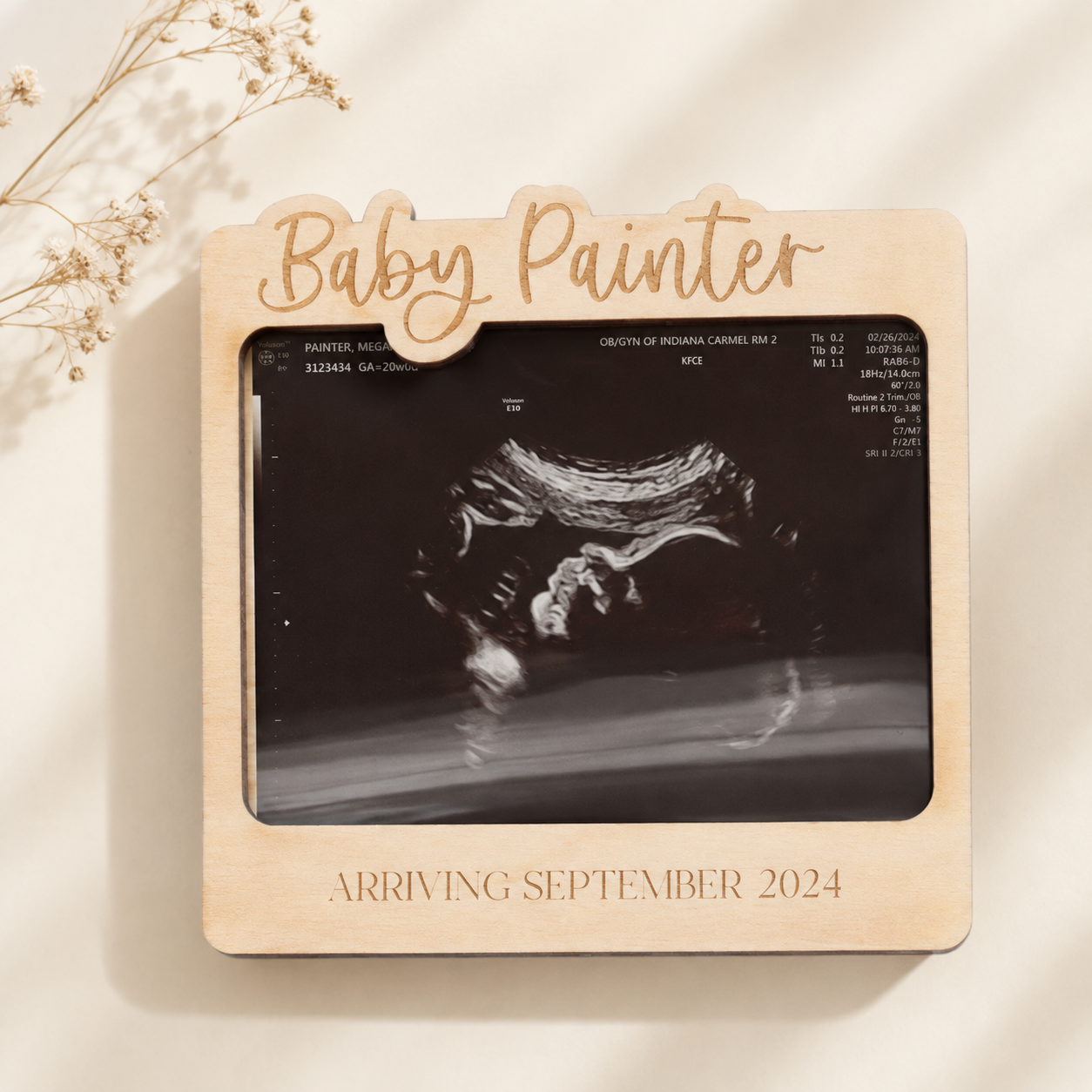 personalized sonogram frame 1.png