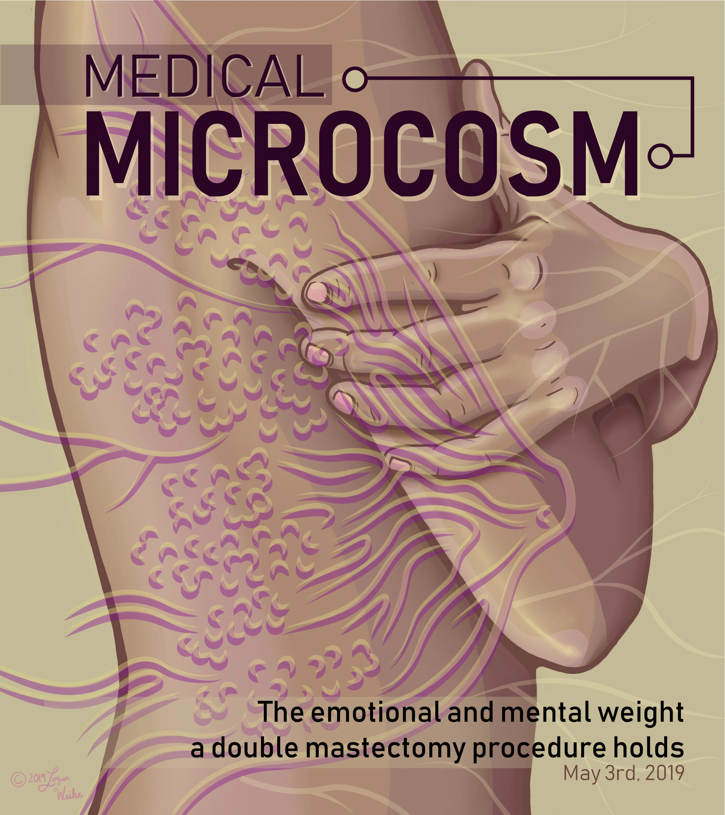 Double Mastectomy Editorial Cover